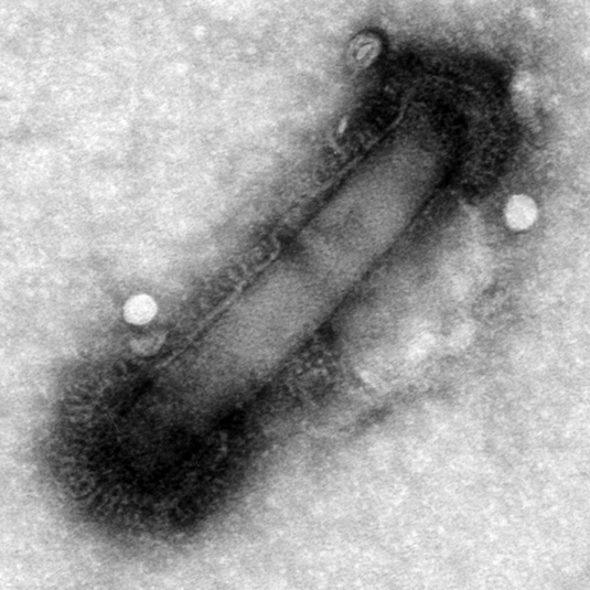 Baculovirus (doppelsträngiger, filamentöser DNA-Virus)